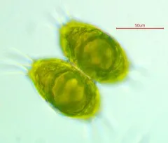Staurastrum longispinum thumbnail 2