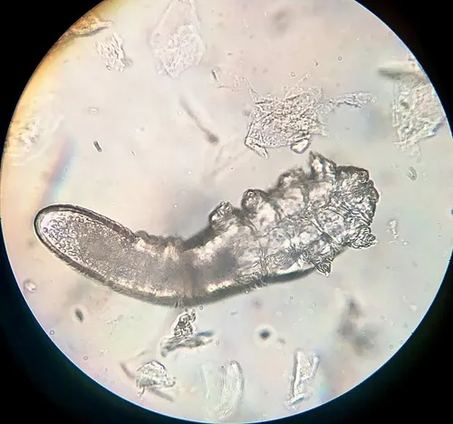 Human Face Mite