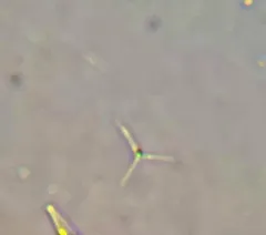 Actinastrum hantzschii thumbnail 1