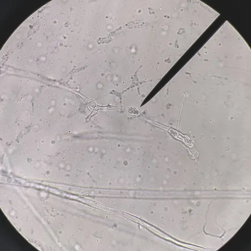 Mucor hiemalis