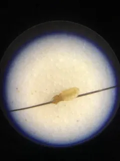cat biting louse thumbnail 2