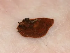 Oak Curtain Crust Fungus thumbnail 2