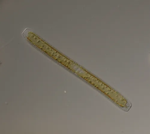 Nitzschia sigmoidea