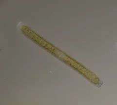 Nitzschia sigmoidea thumbnail 1