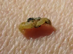 Mantle Pea Crab thumbnail 3
