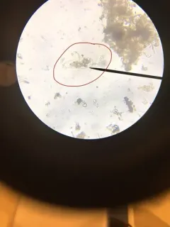 Cyphoderia ampulla thumbnail 4