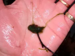 Rhizoclonium tortuosum thumbnail 4