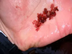Membranoptera fabriciana thumbnail 3