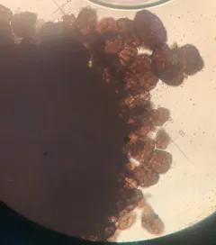 Berkleasmium conglobatum thumbnail 1