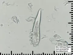 Human Face Mite thumbnail 2
