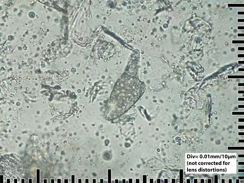 Human Follicle Mite