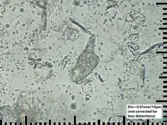 Human Follicle Mite thumbnail 1