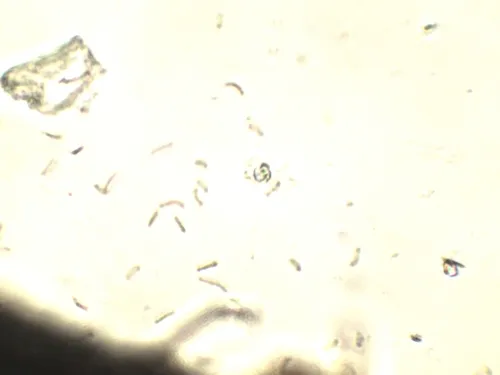 Diatrype undulata