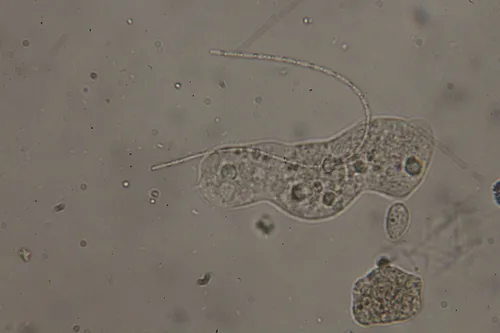 Limnothrix redekei