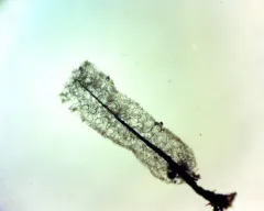 Stemonitopsis amoena thumbnail 2
