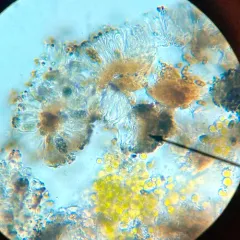 Tiny Button Lichen thumbnail 4