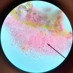 Firedot Lichen thumbnail 3