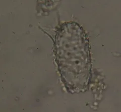Euglypha acanthophora thumbnail 4
