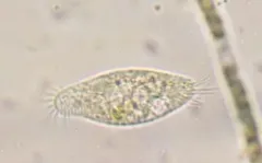 Holosticha pullaster thumbnail 2