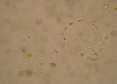 Chaetoceros socialis thumbnail 2