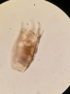 Keratella serrulata thumbnail 2