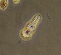 Gomphonema truncatum thumbnail 2