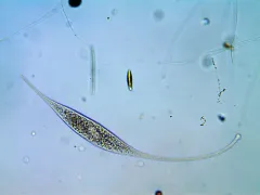 Amphileptus procerus thumbnail 3