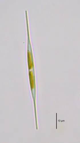 Nitzschia acicularis