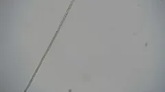 Planktothrix agardhii thumbnail 1