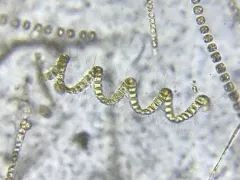 Chaetoceros debilis thumbnail 2