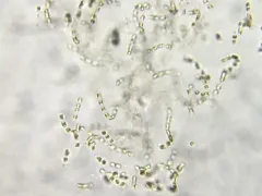 Chaetoceros socialis thumbnail 3