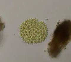 Pseudopediastrum boryanum thumbnail 2