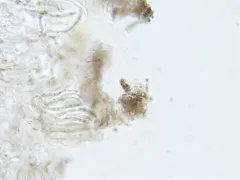 Ascocalyx berenice thumbnail 2