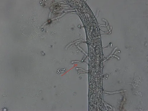 Drechmeria coniospora