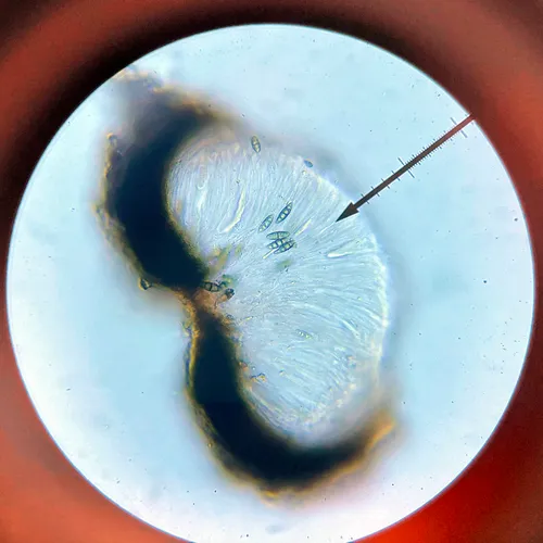 Eopyrenula intermedia