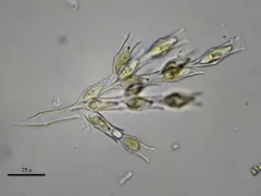 Dinobryon divergens thumbnail 3