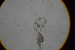 Euglypha strigosa thumbnail 4