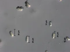 Phycomyces nitens thumbnail 2