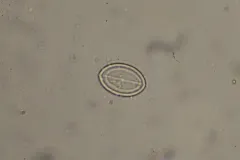 Cocconeis placentula thumbnail 4