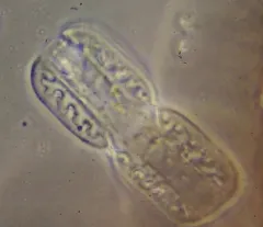 Entomoneis ornata thumbnail 3