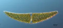 Closterium ehrenbergii thumbnail 2