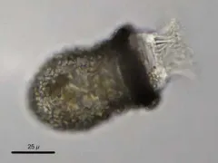 Codonella cratera thumbnail 3