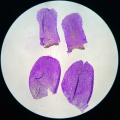 Imbricate Bog-moss thumbnail 4