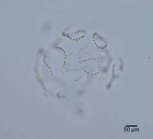 Chaetoceros socialis