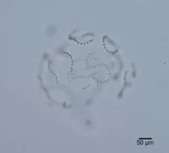 Chaetoceros socialis thumbnail 1