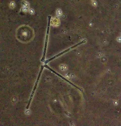 Asterionella formosa thumbnail 2