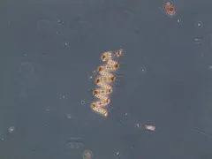 Chaetoceros debilis thumbnail 3
