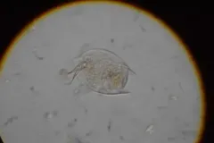 Lepadella acuminata thumbnail 4