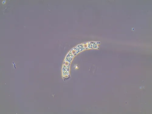 Eucampia zodiacus