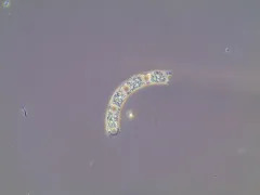 Eucampia zodiacus thumbnail 1
